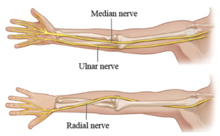 Tingling in arms or hands? Try nerve flossing exercises | MPH