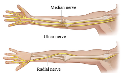 pinched nerve numbness in arm